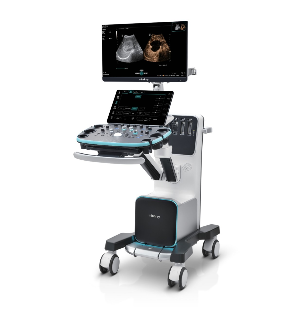 Mindray Resona I9, equipo del catálogo de referencia